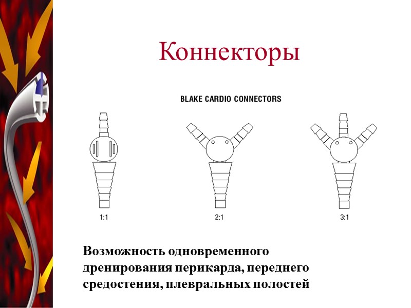 Коннекторы Возможность одновременного дренирования перикарда, переднего средостения, плевральных полостей